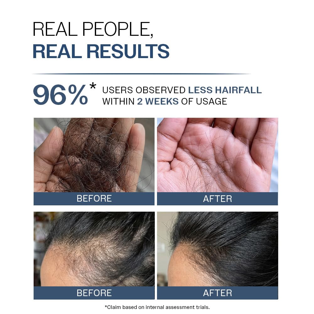 Bare Anatomy Anti-Hair Fall Shampoo | Provides 5X Hair Fall Control Suitable for All Hair Types | Enriched with Adenosine and Peptides | 250 ml - Image 5