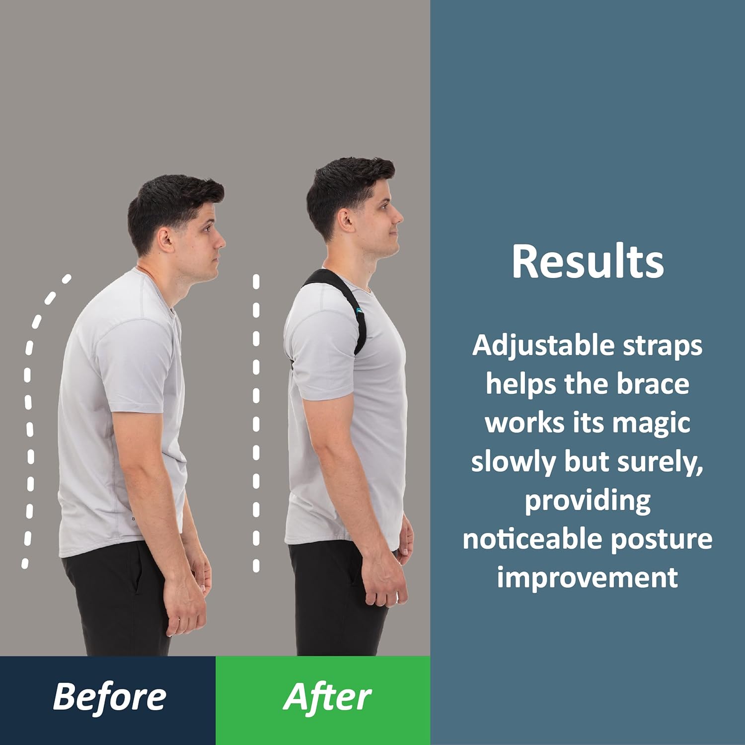 ComfyBrace Posture Corrector-Back Brace for Men and Women- Fully Adjustable Straightener for Mid, Upper Spine Support- Neck, Shoulder, Clavicle and Back Pain Relief-Breathable - Image 2