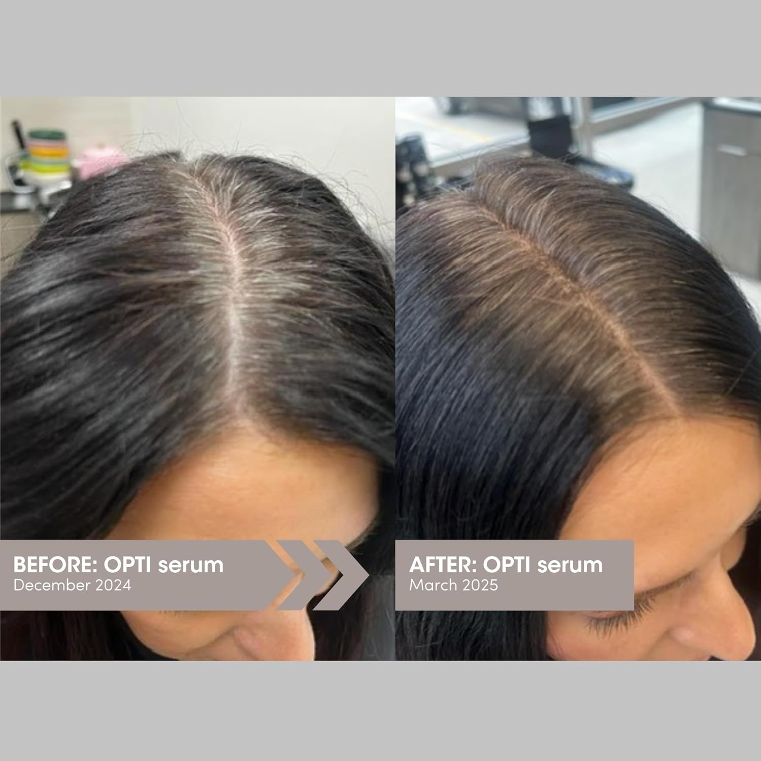 SEVEN Satara Opti Anti Grey Hair Serum, Triple-Action Oil Serum for Anti-Frizz & Damaged Hair Growth, Shine Enhancing, Frizzy Control, Color Reversal, Thinning Reduction, 1.4 fl oz, 42 ml - Image 2
