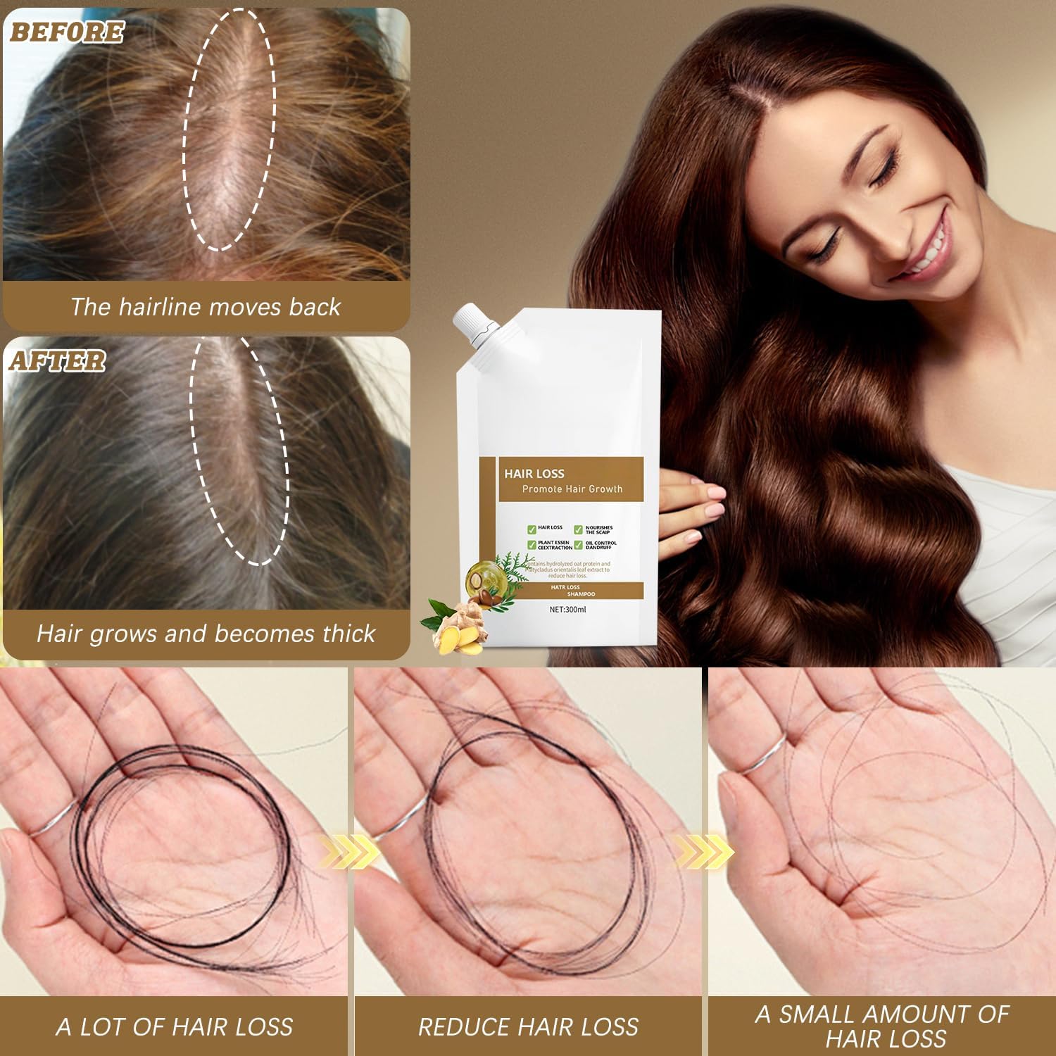 Anti-Hair Fall Hair Loss Shampoo, Promote Hair Growth Shampoo, Rich in Various Plant Extracts, for All Hair Types (300ml / 1 Bottle) - Image 5