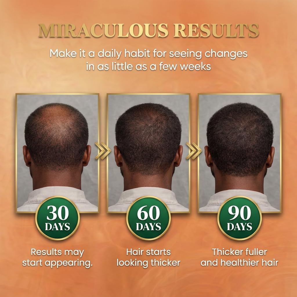 Batana Oil for Hair Growth Dr Sebi, 100% Raw Organic Batana Hair Mask from Honduras, Wild Growth Hair Oil, Scalp Oil Promotes Hair Thickness, Prevents Loss for Men & Women, 4.06 fl oz - Image 5