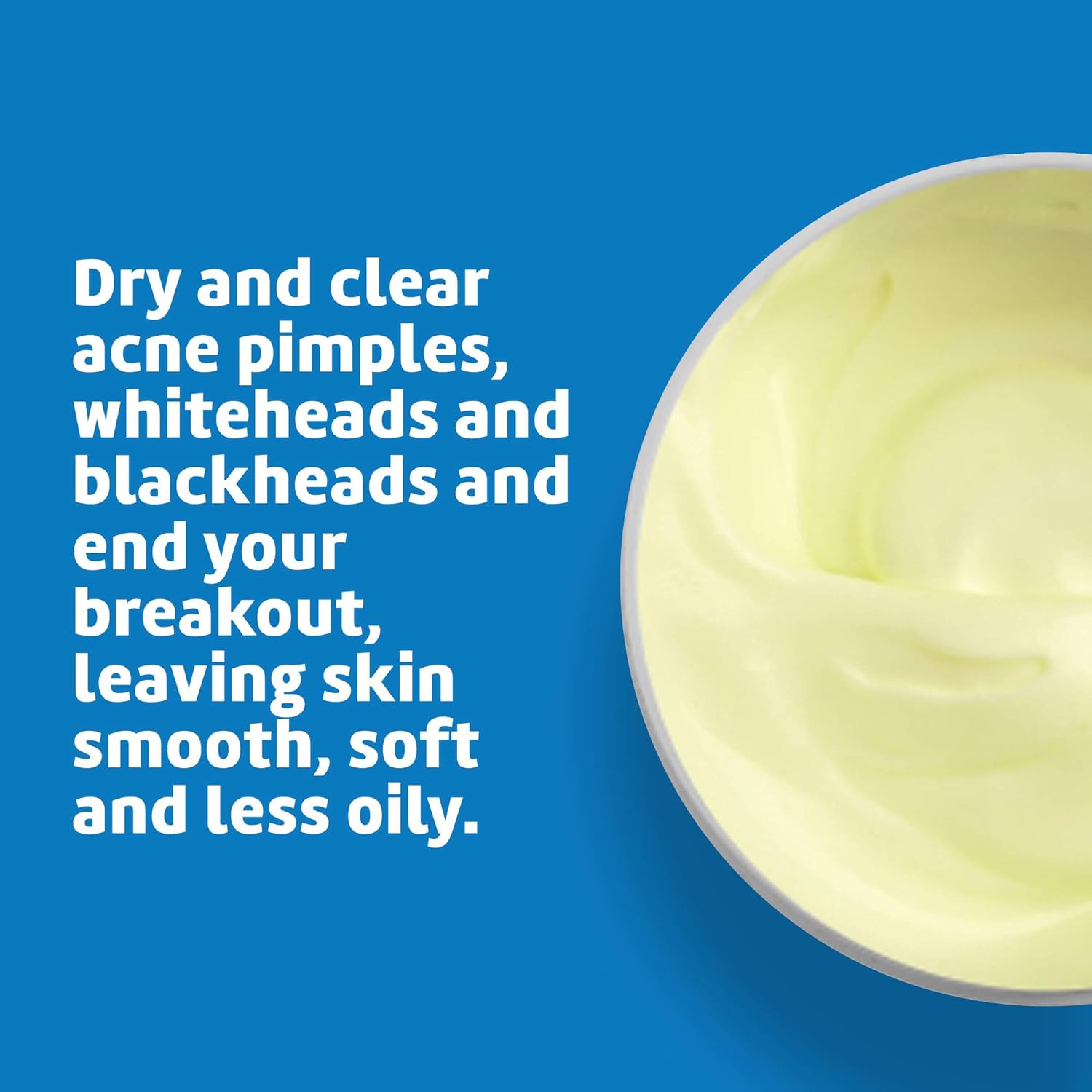 De La Cruz Sulfur Ointment - Cystic Acne Treatment for Face and Body - Daily 10 Min Spot Treatment Mask - Safe and Effective Game Changing Hormonal Acne Treatment That Clears Up Pimples 5.5 OZ. - Image 4