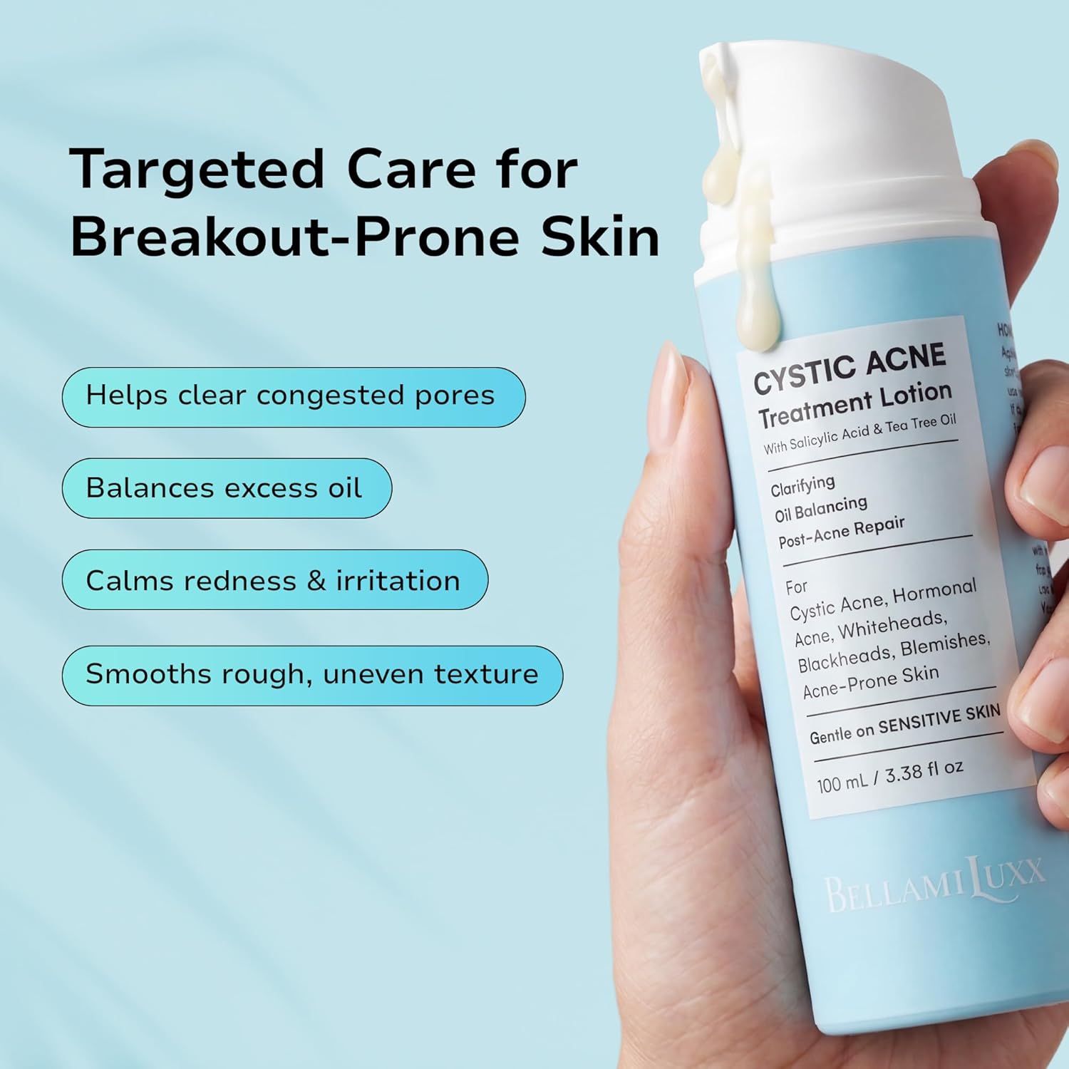BellamiLuxx Cystic Acne Treatment for Face: Hormonal Acne Treatment Cream for Teens & Adults - Salicylic Acid & Tea Tree Oil Pimple Spot Remover - Anti-Acne Moisturizer Reduces Redness, Blemishes - Image 2