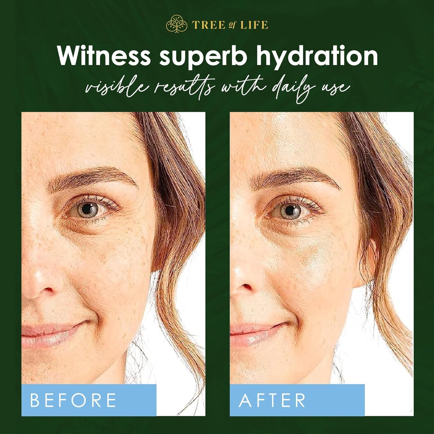 Tree of Life Beauty Hyaluronic Acid Serum, Skin Brightening Face Oil for Dark and Age Spots, Facial Serums for Dry and Sensitive Skin Care with Vitamin E for Soft Smooth Skin, 2 Fl Oz - Image 5