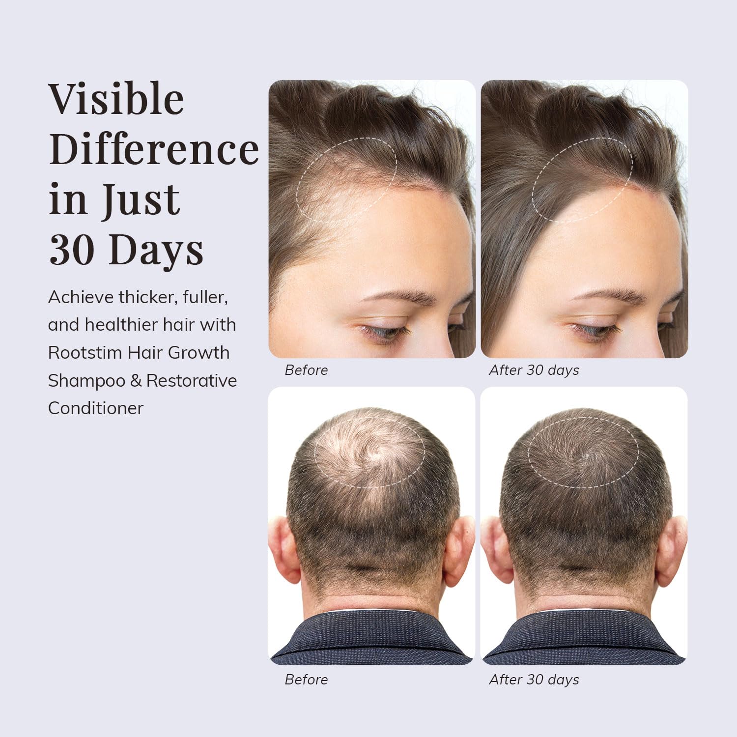 Hair Growth Shampoo and Conditioner Set - Rosemary & Biotin Shampoo and Conditioner for Hair Thickening - Botanical Boost for a Healthy Scalp, Hair Growth and Strengthen - Image 4