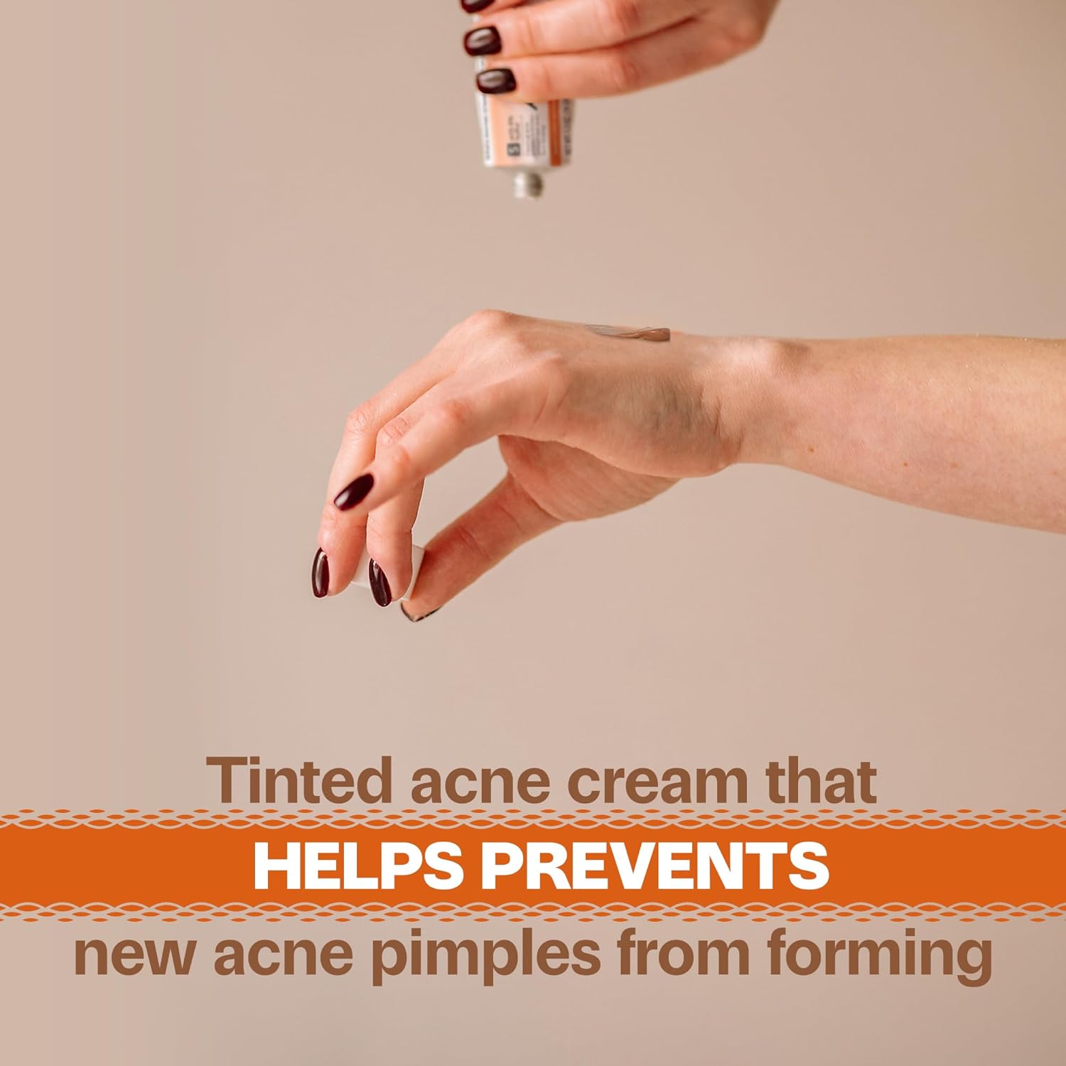 Adult Acnomel Acne Medication Cream, 1.3 Ounces - Image 2