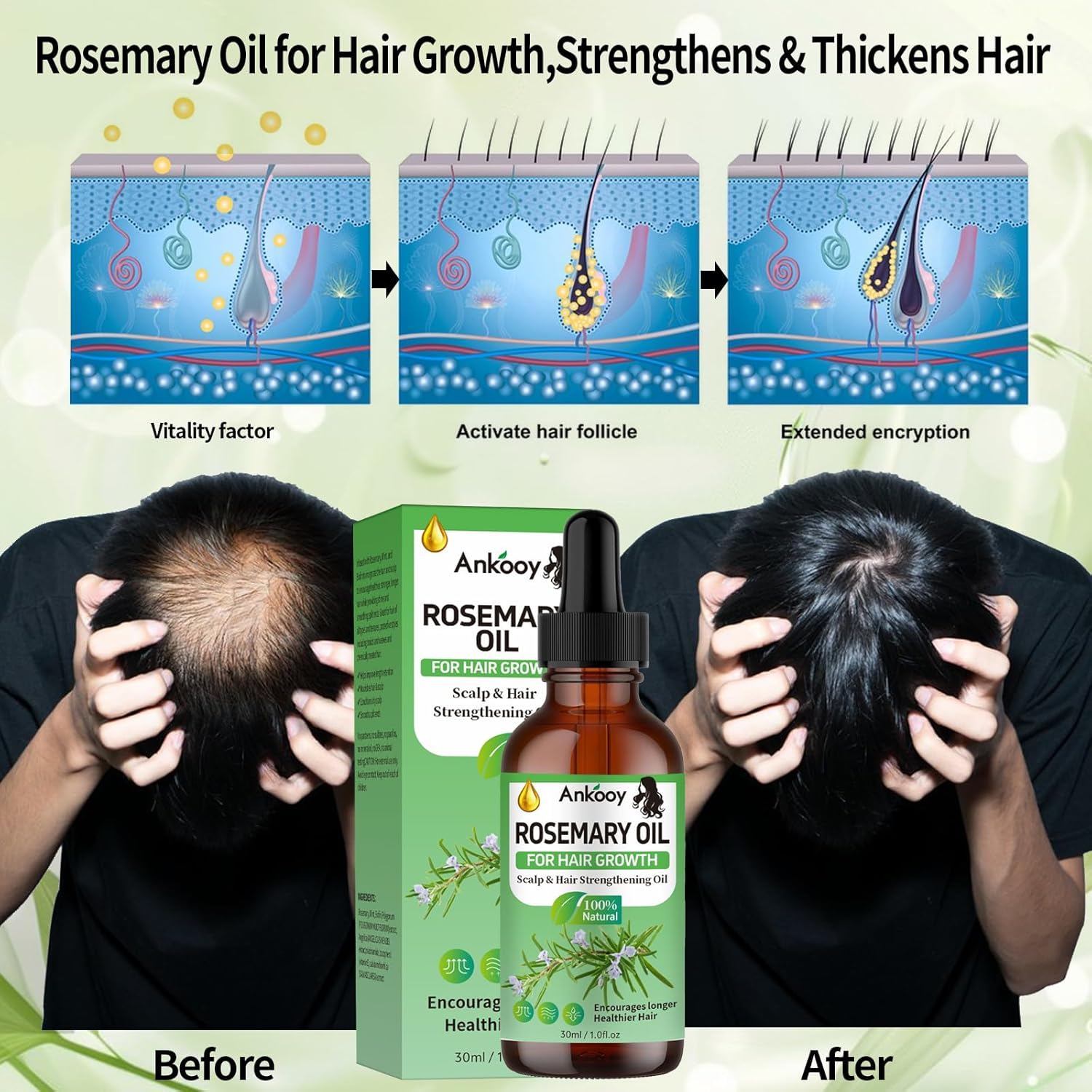 3 Pack Rosemary Oil for Hair Growth,Rosemary Hair Growth Oil,Strengthening Oil for Dry Damaged Hair,Hair Loss Treatment & Thickens Hair,Scalp Care Promotes Hair Thickness for Men Women - Image 4