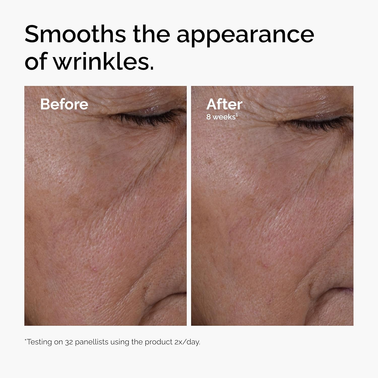 The Ordinary Multi-Peptide + Hyaluronic Acid, Anti-Aging Peptide Serum for Crow’s Feet, Elasticity & Firmness, 1 Fl Oz - Image 5