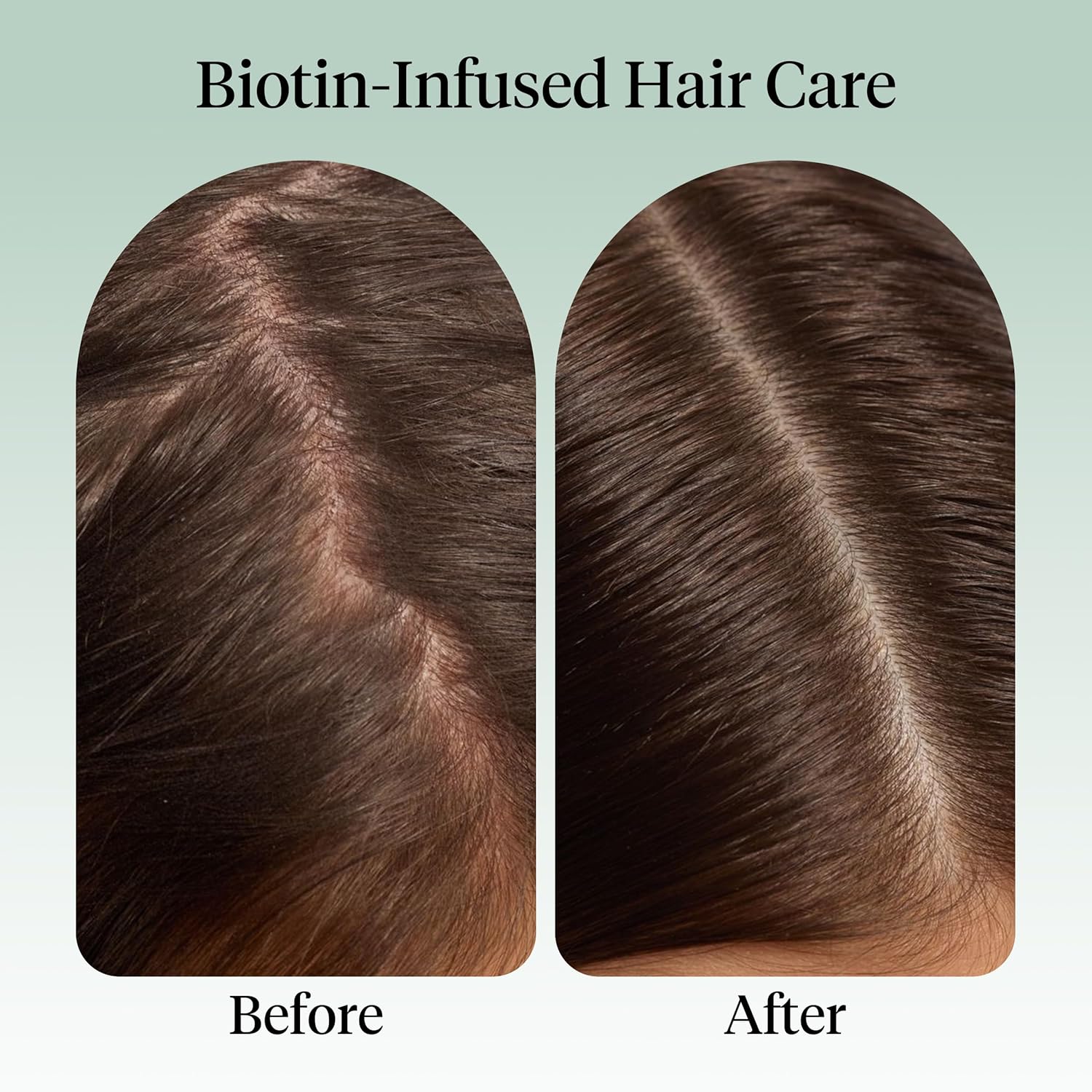 Kitsch Rosemary Oil for Hair Growth – Hair Oil with Biotin, Castor & Jojoba – Pre-Wash Scalp oil for Hair Care – Lavender Scent – 10mL | Ideal Gifts for Women - Image 4