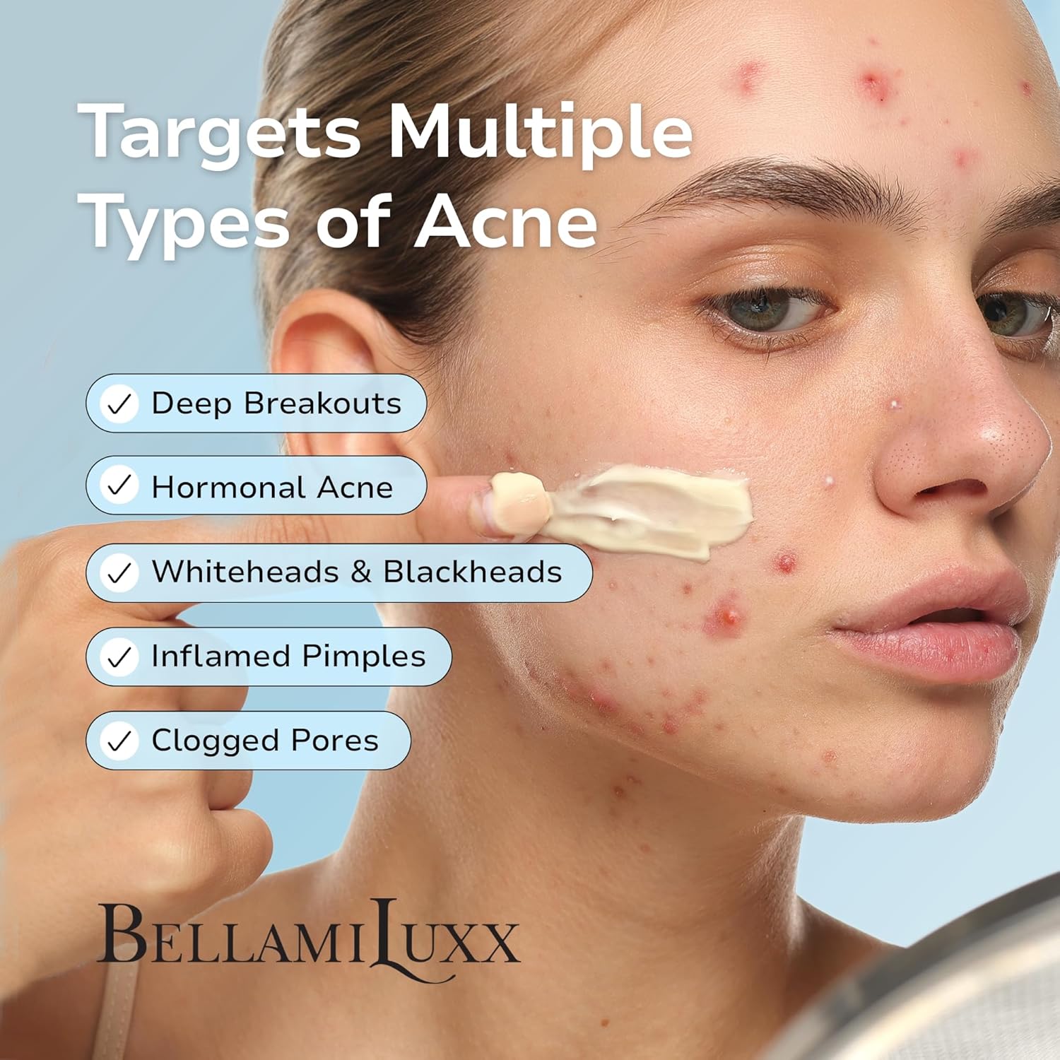 BellamiLuxx Cystic Acne Treatment for Face: Hormonal Acne Treatment Cream for Teens & Adults - Salicylic Acid & Tea Tree Oil Pimple Spot Remover - Anti-Acne Moisturizer Reduces Redness, Blemishes - Image 4