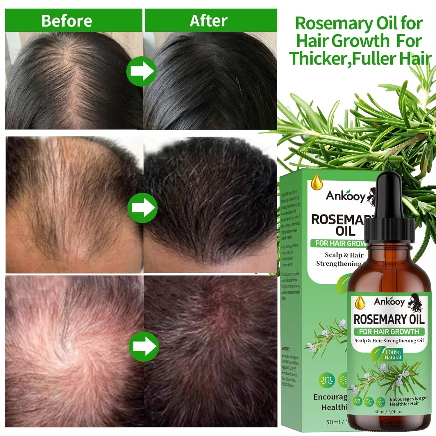 3 Pack Rosemary Oil for Hair Growth,Rosemary Hair Growth Oil,Strengthening Oil for Dry Damaged Hair,Hair Loss Treatment & Thickens Hair,Scalp Care Promotes Hair Thickness for Men Women - Image 3